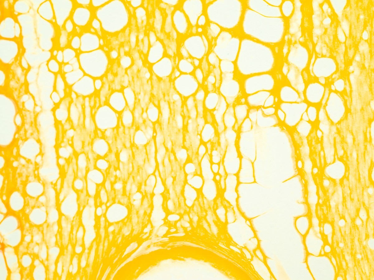 Friedrich Nietzsche: Der&nbsp;Genesende